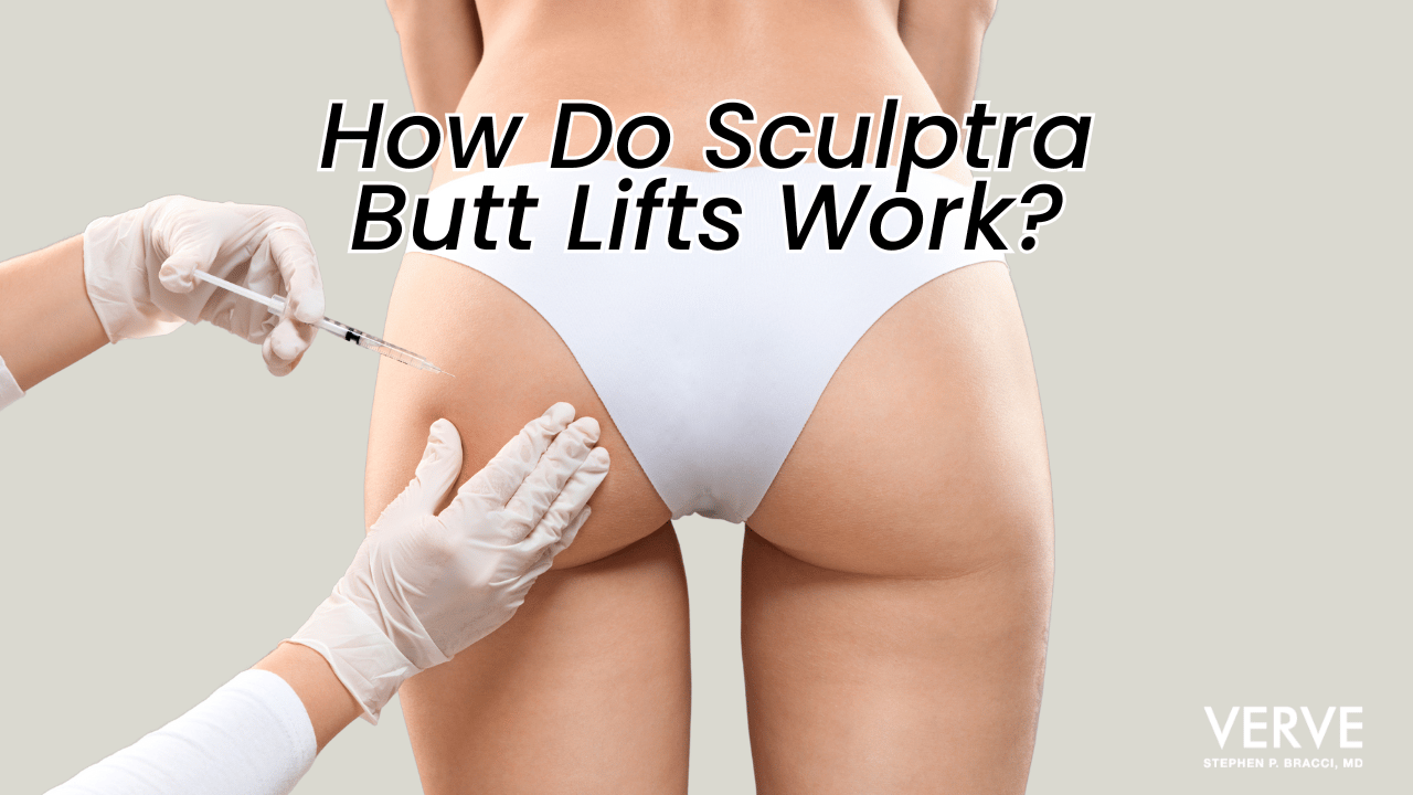 How Do Sculptra Butt Lifts Work? | Non-Surgical Buttock Augmentation | NYC Injections