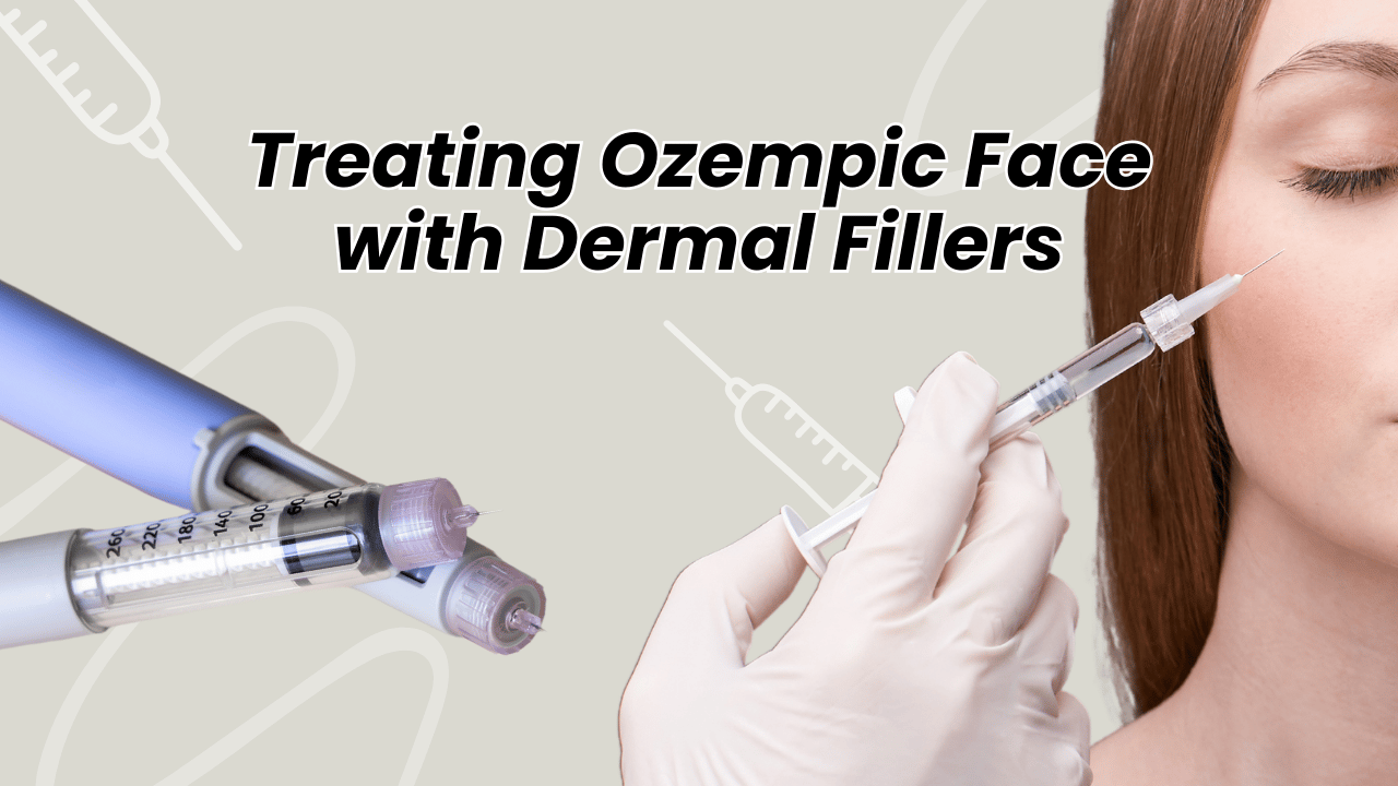 Treating Ozempic Face Sagging Skin with Dermal Fillers | Restoring Lost Facial Fat Support without Plastic Surgery