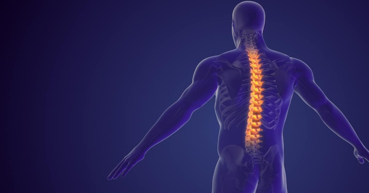 רשלנות רפואית קוודריפרזיס1