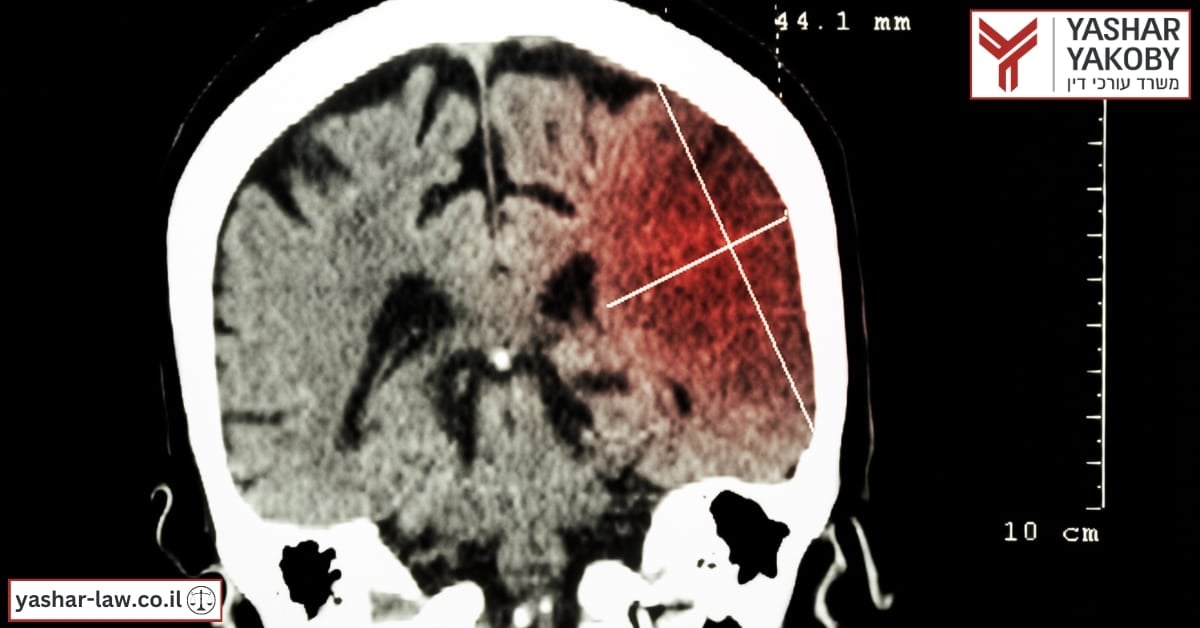 الاخطاء الطبية - احتشاء الدماغ الذي تسبب في الشلل