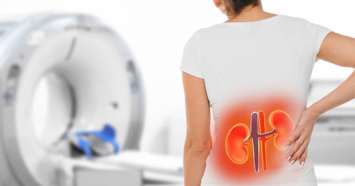 רשלנות רפואית אי ספיקת כליות חריפה