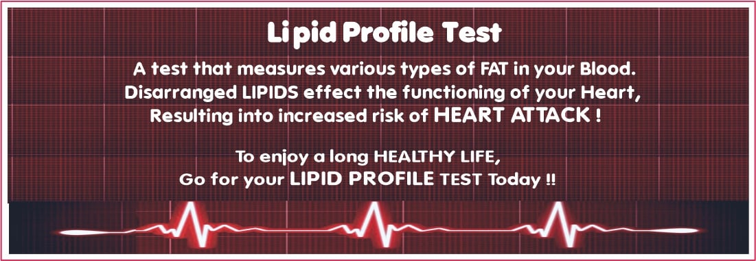 Lipid Profile Test in Amritsar