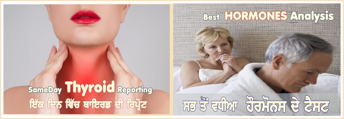 Full Body Checkup in Amritsar