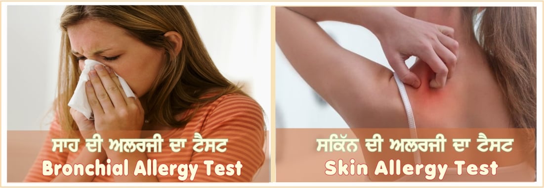 Allergy Test in Amritsar